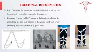TORSIONAL DEFORMITIES
 Use of orthoses for control of internal tibial torsion and excess
femoral anteversion has essentially disappeared.
 However ‘‘twister cables’’ remain a lightweight solution for
controlling hip and foot rotation in the young child with lower
extremity weakness, particularly spina bifida.
 