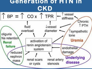 Generation of HTN in
CKD
 