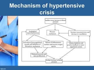 Mechanism of hypertensive
crisis
 