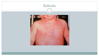 Pediatric Infectious Disease Overview_Part1-1 (2).pptx