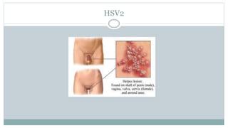 Pediatric Infectious Disease Overview_Part1-1 (2).pptx