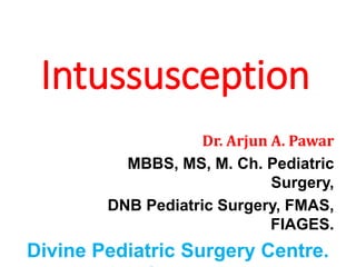 Intussusception
Dr. Arjun A. Pawar
MBBS, MS, M. Ch. Pediatric
Surgery,
DNB Pediatric Surgery, FMAS,
FIAGES.
Divine Pediatric Surgery Centre.
 
