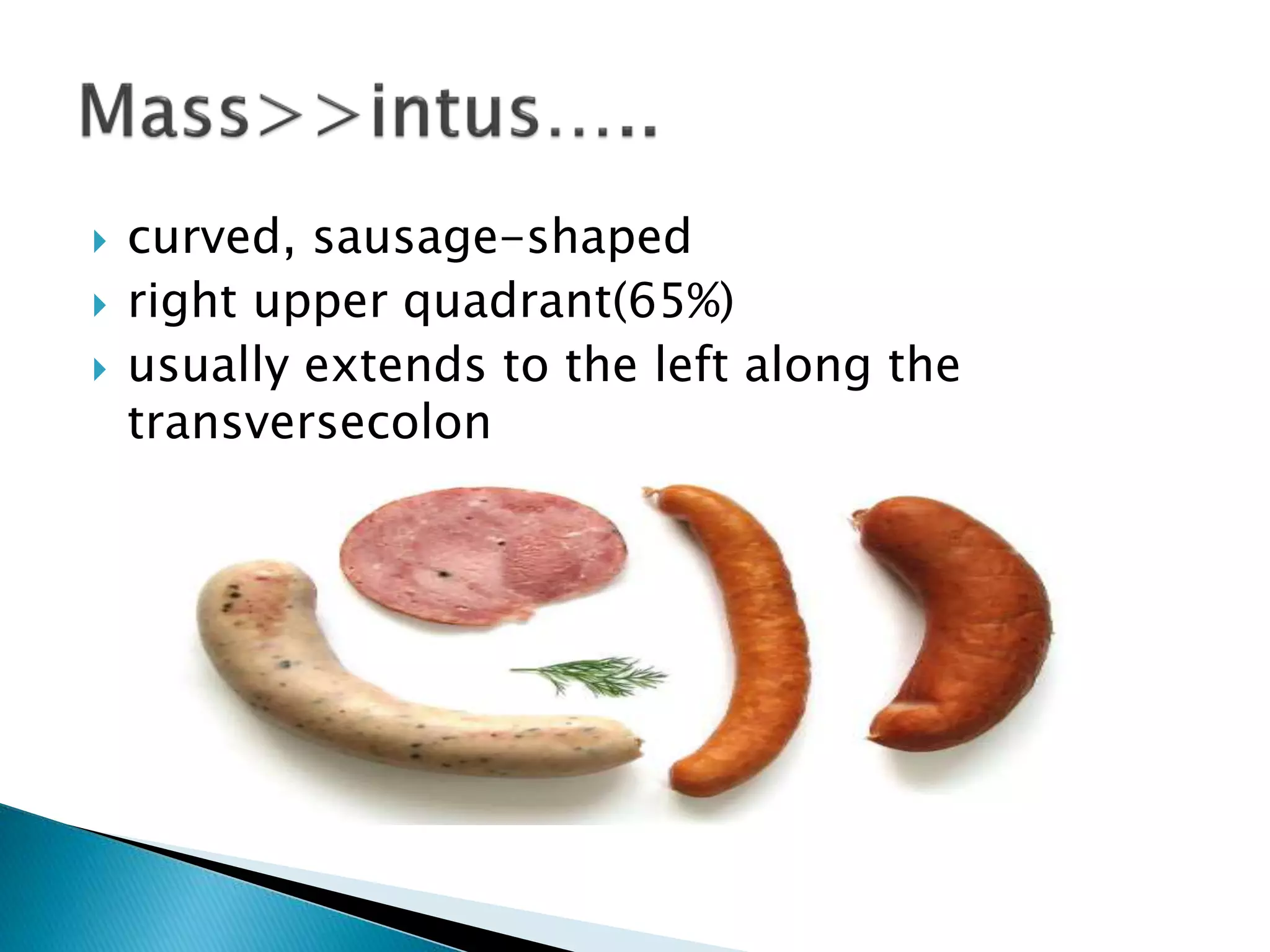  curved, sausage-shaped
 right upper quadrant(65%)
 usually extends to the left along the
transversecolon
 