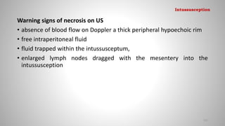 Warning signs of necrosis on US
• absence of blood flow on Doppler a thick peripheral hypoechoic rim
• free intraperitoneal fluid
• fluid trapped within the intussusceptum,
• enlarged lymph nodes dragged with the mesentery into the
intussusception
121
Intussusception
 