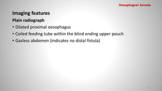 Imaging features
Plain radiograph
• Dilated proximal oesophagus
• Coiled feeding tube within the blind ending upper pouch
• Gasless abdomen (indicates no distal fistula)
14
Oesophageal Atresia
 