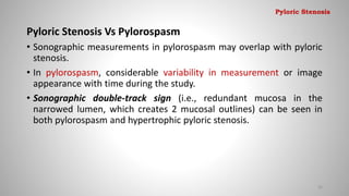 Pyloric Stenosis Vs Pylorospasm
• Sonographic measurements in pylorospasm may overlap with pyloric
stenosis.
• In pylorospasm, considerable variability in measurement or image
appearance with time during the study.
• Sonographic double-track sign (i.e., redundant mucosa in the
narrowed lumen, which creates 2 mucosal outlines) can be seen in
both pylorospasm and hypertrophic pyloric stenosis.
26
Pyloric Stenosis
 