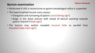 Barium examination
• Performed if USG is inconclusive or gastro-oesophageal reflux is suspected.
• The hypertrophied muscle mass causes:
• Elongation and narrowing of pyloric canal (‘string sign’)
• Bulge in the distal antrum with streak of barium pointing towards
pyloric channel (‘beak sign’)
• The barium may outline crowded mucosal folds as parallel lines
(‘double/triple track sign’).
27
Pyloric Stenosis
 