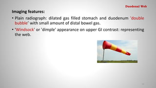 Imaging features:
• Plain radiograph: dilated gas filled stomach and duodenum 'double
bubble’ with small amount of distal bowel gas.
• 'Windsock' or 'dimple' appearance on upper GI contrast: representing
the web.
43
Duodenal Web
 