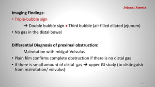 Imaging Findings:
• Triple-bubble sign
 Double bubble sign + Third bubble (air filled dilated jejunum)
• No gas in the distal bowel
Differential Diagnosis of proximal obstruction:
Malrotation with midgut Volvulus
• Plain film confirms complete obstruction if there is no distal gas
• If there is small amount of distal gas  upper GI study (to distinguish
from malrotation/ volvulus)
58
Jejunal Atresia
 