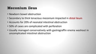 Meconium ileus
• Newborn bowel obstruction
• Secondary to thick tenacious meconium impacted in distal ileum
• Accounts for 20% of neonatal intestinal obstruction
• 50% of cases are complicated with perforation
• Usually managed conservatively with gastrograffin enema washout in
uncomplicated intestinal obstruction
67
 