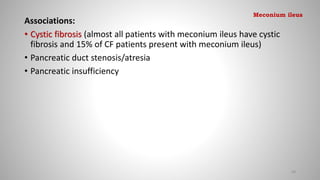Associations:
• Cystic fibrosis (almost all patients with meconium ileus have cystic
fibrosis and 15% of CF patients present with meconium ileus)
• Pancreatic duct stenosis/atresia
• Pancreatic insufficiency
68
Meconium ileus
 
