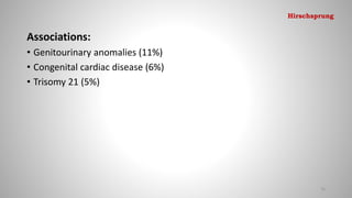 Associations:
• Genitourinary anomalies (11%)
• Congenital cardiac disease (6%)
• Trisomy 21 (5%)
76
Hirschsprung
 