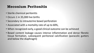 Meconium Peritonitis
• Sterile chemical peritonitis
• Occurs 1 in 35,000 live births
• Secondary to intrauterine bowel perforation
• Associated with a mortality rate of up to 60%,
• When recognized early, a good clinical outcome can be achieved
• Bowel content leakage causes intense inflammation and dense fibrotic
tissue formation, subsequent peritoneal calcification (paracolic gutters
and below the diaphragm)
91
 