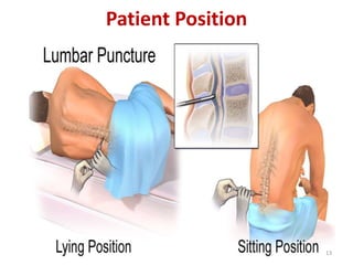 Patient Position
13
 