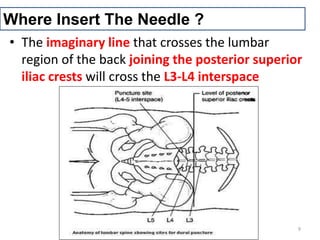 Where Insert The Needle ?
• The imaginary line that crosses the lumbar
region of the back joining the posterior superior
iliac crests will cross the L3-L4 interspace
9
 