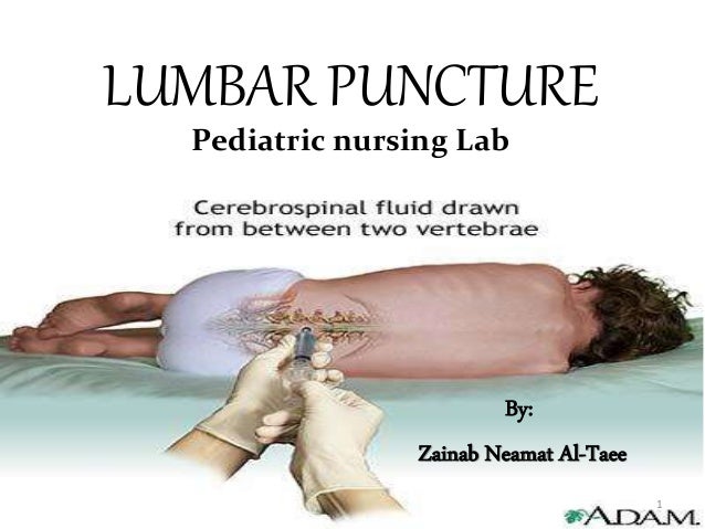 Pediatric lumbar puncture