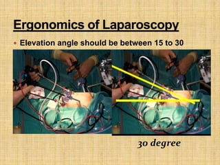  Elevation angle should be between 15 to 30
degree
30 degree
 