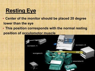  Center of the monitor should be placed 20 degree
lower than the eye
 This position corresponds with the normal resting
position of occulomotor muscle
 