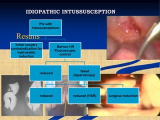 IDIOPATHIC INTUSSUSCEPTION
Results
Pts with
intussusceptionn
Initial surgery
contraindication for
hydrostatic
reduction
Barium HR
Fluoroscopic
control
reduced
failed
(laparoscopy)
reduced reduced (HSR) surgical reduction
 