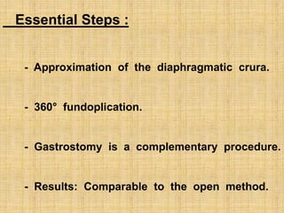 Essential Steps :
- Approximation of the diaphragmatic crura.
- 360° fundoplication.
- Gastrostomy is a complementary procedure.
- Results: Comparable to the open method.
 