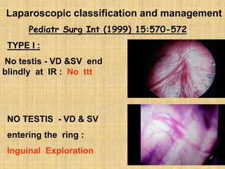 Laparoscopic classification and management
Pediatr Surg Int (1999) 15:570-572
TYPE I :
No testis - VD &SV end
blindly at IR : No ttt
NO TESTIS - VD & SV
entering the ring :
Inguinal Exploration
 