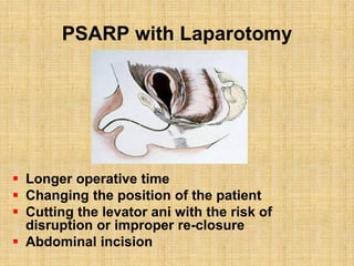 PSARP with Laparotomy
 Longer operative time
 Changing the position of the patient
 Cutting the levator ani with the risk of
disruption or improper re-closure
 Abdominal incision
 