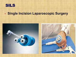  Single Incision Laparoscopic Surgery
 