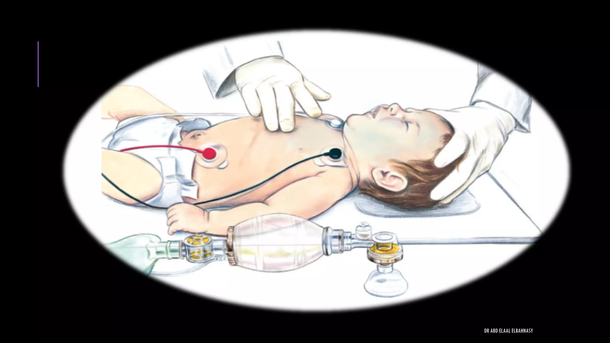 DR ABD ELAAL ELBAHNASY
 