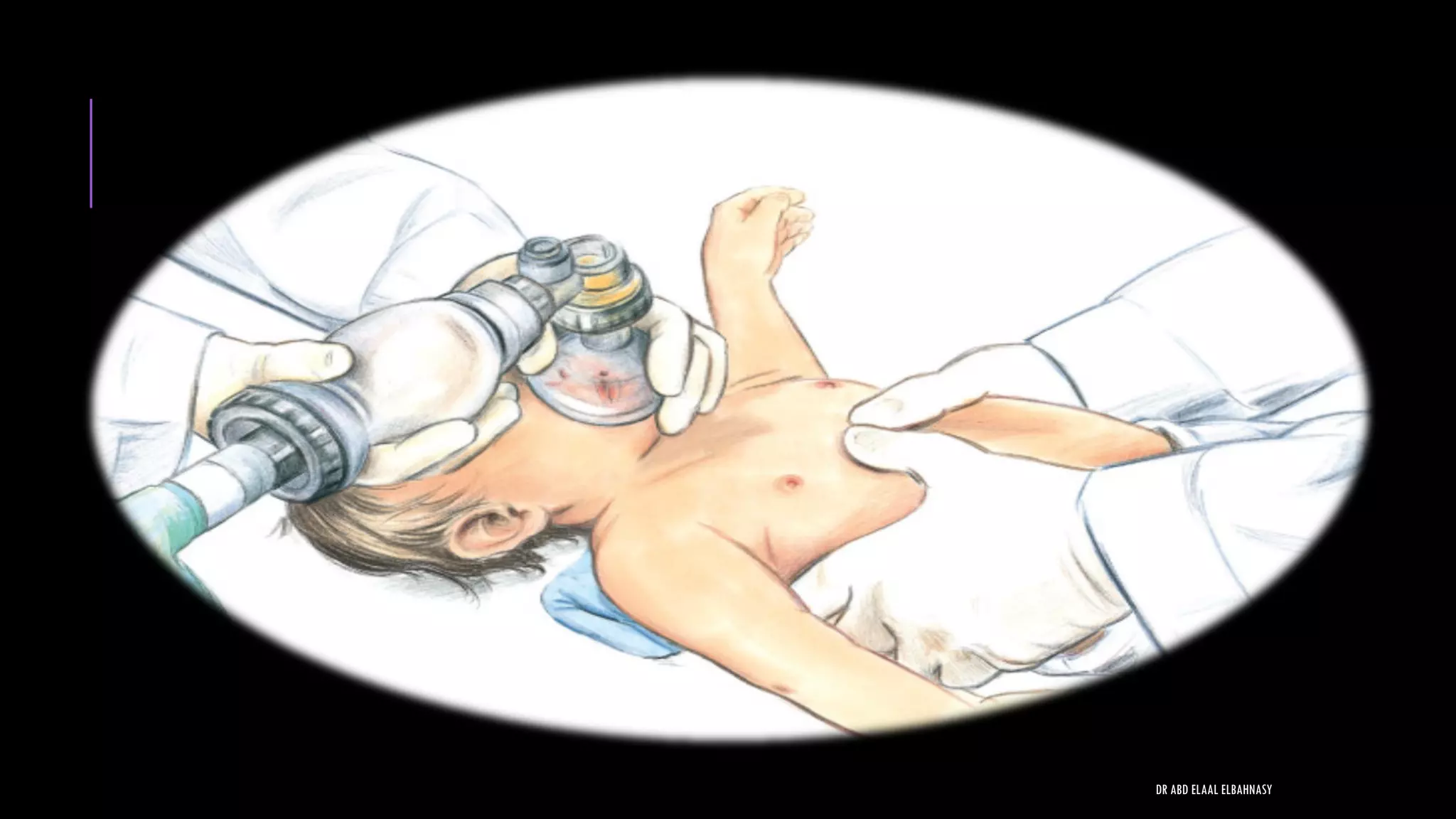 DR ABD ELAAL ELBAHNASY
 