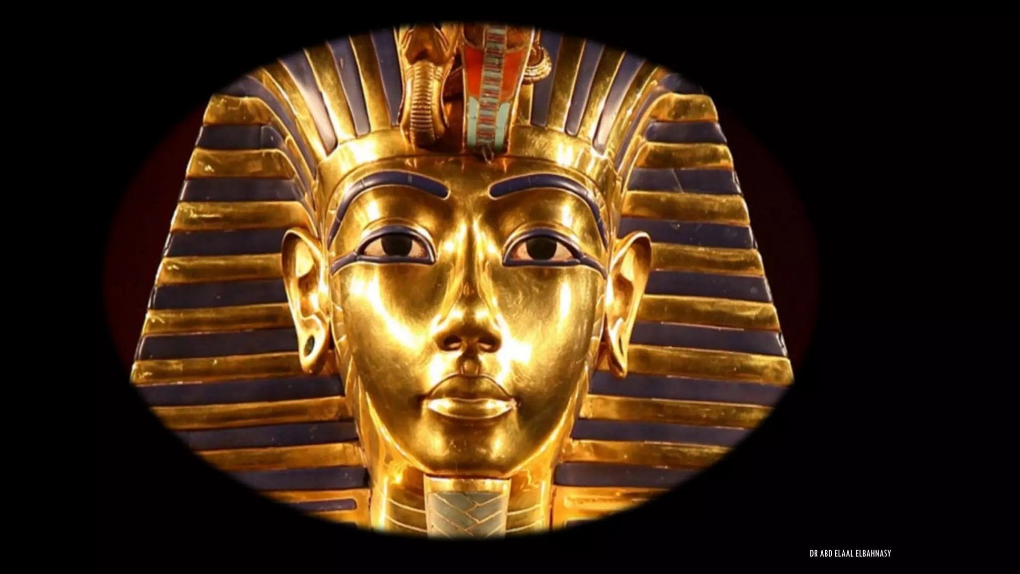 DR ABD ELAAL ELBAHNASY
 