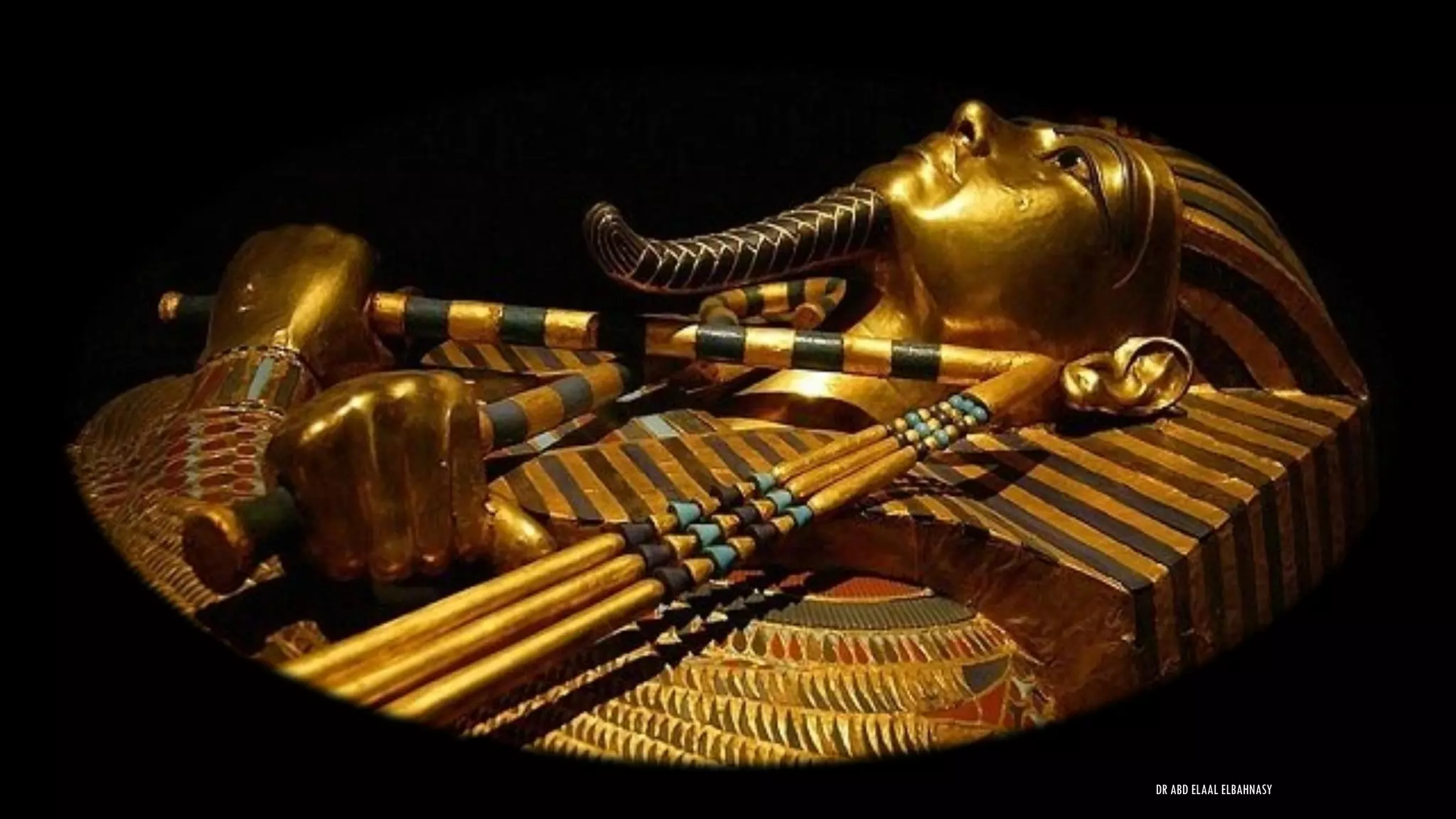 DR ABD ELAAL ELBAHNASY
 