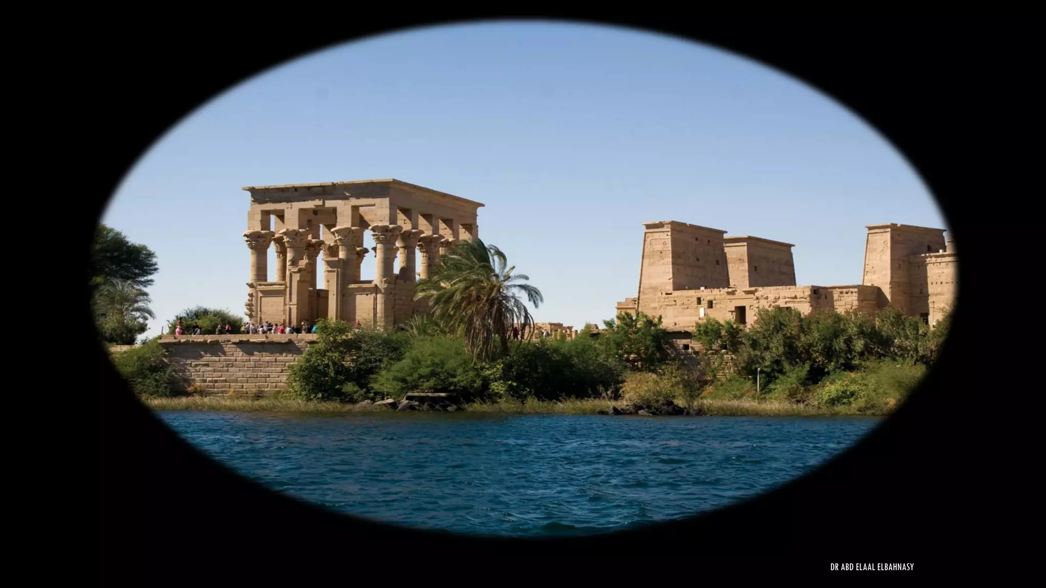 DR ABD ELAAL ELBAHNASY
 