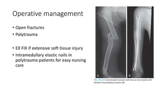 Operative management
• Open fractures
• Polytrauma
• EX FIX if extensive soft tissue injury
• Intramedullary elastic nails in
polytrauma patients for easy nursing
care
 