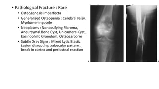 • Pathological Fracture : Rare
• Osteogenesis Imperfecta
• Generalised Osteopenia : Cerebral Palsy,
Myelomeningocele
• Neoplasms : Nonossifying Fibroma,
Aneursymal Bone Cyst, Unicameral Cyst,
Eosinophilic Granulom, Osteosarcome
• Subtle Xray Signs : Mixed Lytic Blastic
Lesion disrupting trabecular pattern ,
break in cortex and periosteal reaction
 
