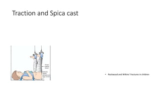 Traction and Spica cast
• Rockwood and Wilkins’ fractures in children
 