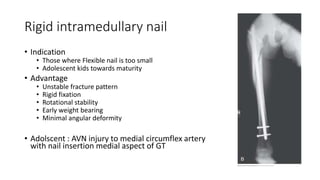 Rigid intramedullary nail
• Indication
• Those where Flexible nail is too small
• Adolescent kids towards maturity
• Advantage
• Unstable fracture pattern
• Rigid fixation
• Rotational stability
• Early weight bearing
• Minimal angular deformity
• Adolscent : AVN injury to medial circumflex artery
with nail insertion medial aspect of GT
 