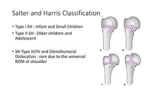 Salter and Harris Classification
• Type I SH : Infant and Small Children
• Type II SH : Older children and
Adolescent
• SH Type III/IV and Glenohumeral
Dislocation : rare due to the universal
ROM at shoulder
 
