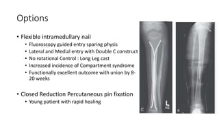 Options
• Flexible intramedullary nail
• Fluoroscopy guided entry sparing physis
• Lateral and Medial entry with Double C construct
• No rotational Control : Long Leg cast
• Increased incidence of Compartment syndrome
• Functionally excellent outcome with union by 8-
20 weeks
• Closed Reduction Percutaneous pin fixation
• Young patient with rapid healing
 