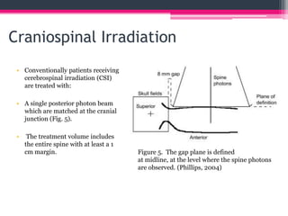 Pediatric medulloblastoma | PPTX