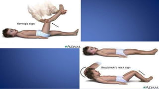 pediatric meningitis.pptx