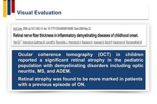 Visual Evaluation
• Ocular coherence tomography (OCT) in children
reported a significant retinal atrophy in the pediatric
population with demyelinating disorders including optic
neuritis, MS, and ADEM.
• Retinal atrophy was found to be more marked in patients
with a previous episode of ON.
 