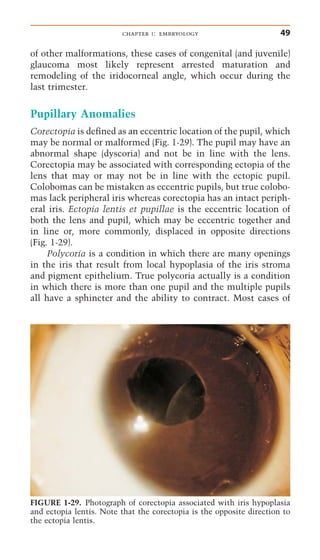 Pediatric Neuro-Ophthalmology........pdf