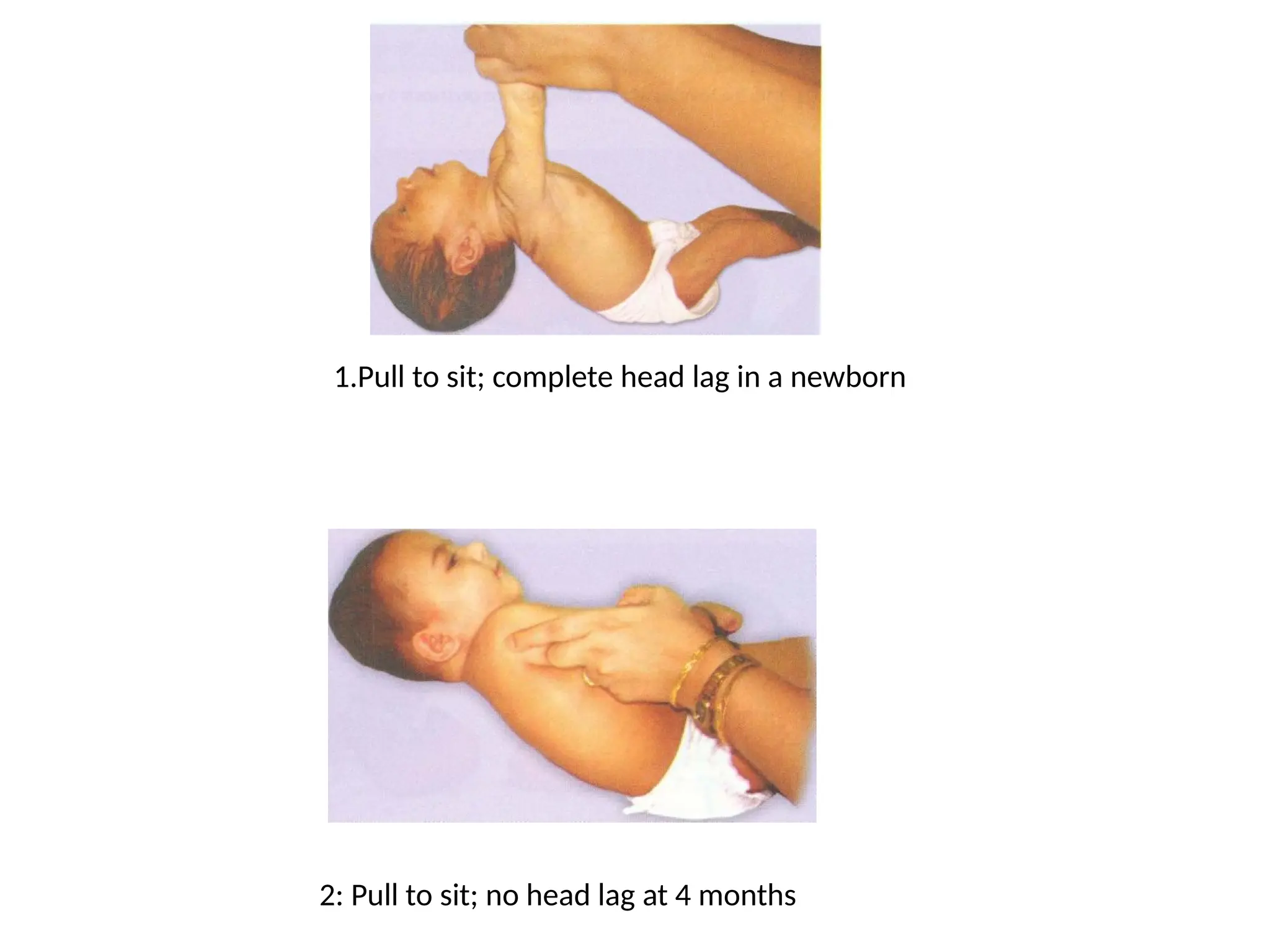 pediatric neuro assessmentvudthuvhjj.pptx