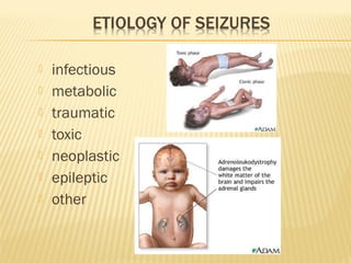 







infectious
metabolic
traumatic
toxic
neoplastic
epileptic
other

 