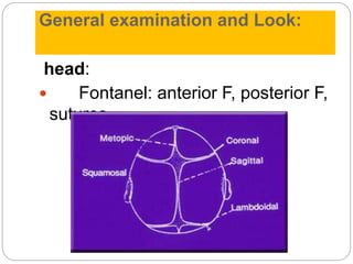 General examination and Look:
head:
 Fontanel: anterior F, posterior F,
sutures
 