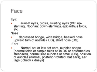 Face
Eye:
 sunset eyes, ptosis, slunting eyes (DS: up-
slanting, Noonan: down-slanting), epicanthus folds,
etc
Nose
 depressed bridge, wide bridge, beaked nose
upward turn of nostrils ( DS), short nose (DS)
Ears
 Normal set or low set ears, auricles shape
(normal folds or simple folds as in DS or deformed as
stenosed), normal size auricles or small (DS), position
of auricles (normal, posterior rotated, bat ears), ear
tags ( check kidneys)
 