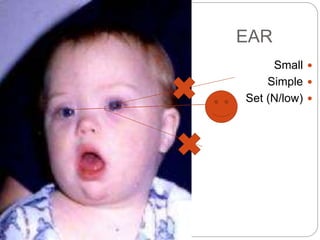 EAR
Small
Simple
Set (N/low)
 