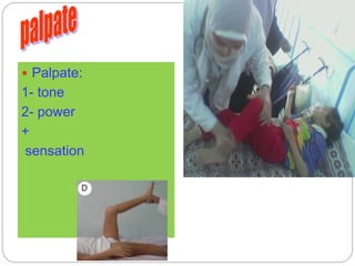  Palpate:
1- tone
2- power
+
sensation
 