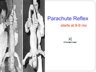Parachute Reflex
starts at 8-9 mo
 