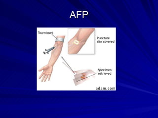 Pediatric Nursing | PPT
